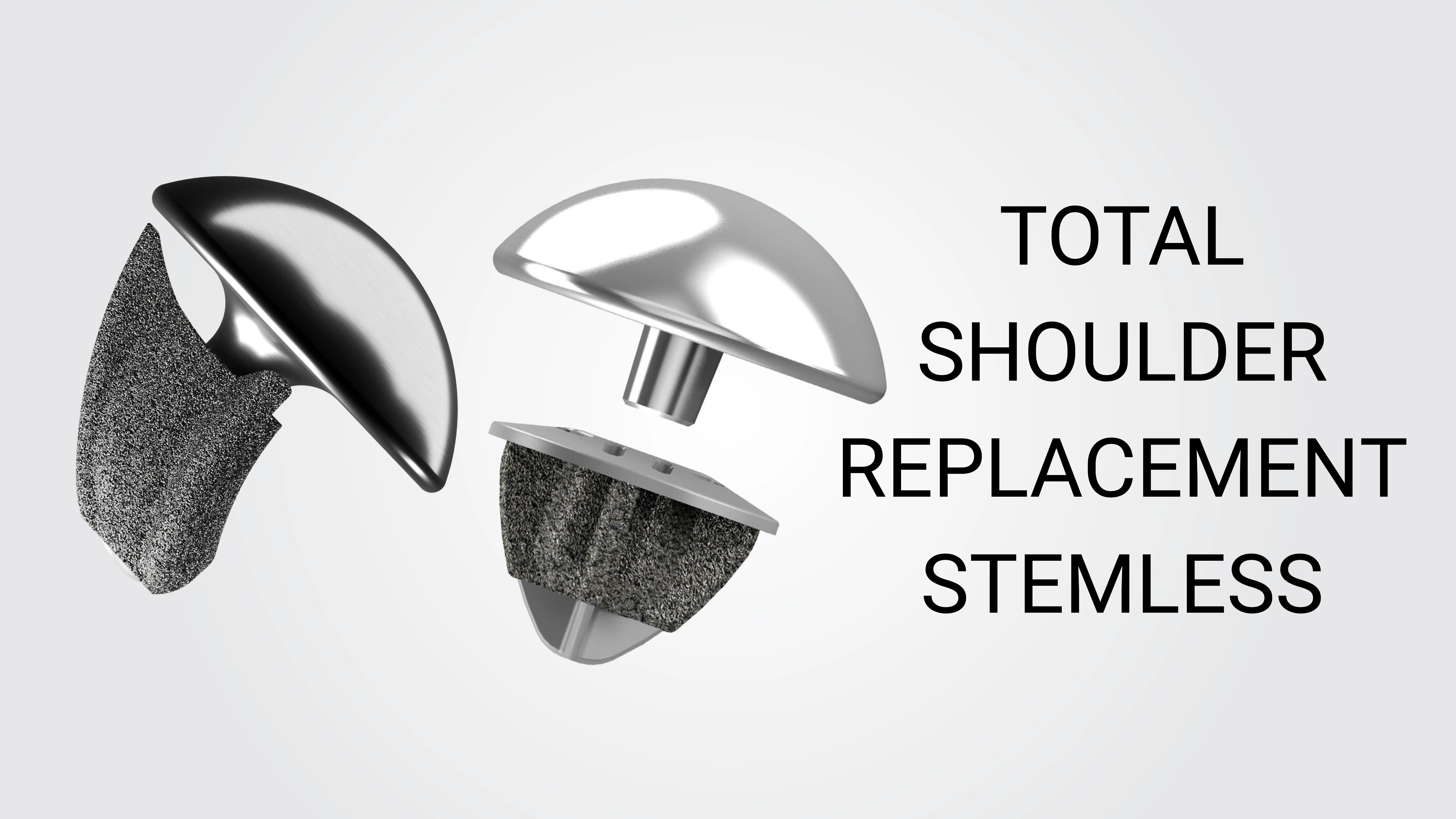 Total Shoulder Replacement Stemless