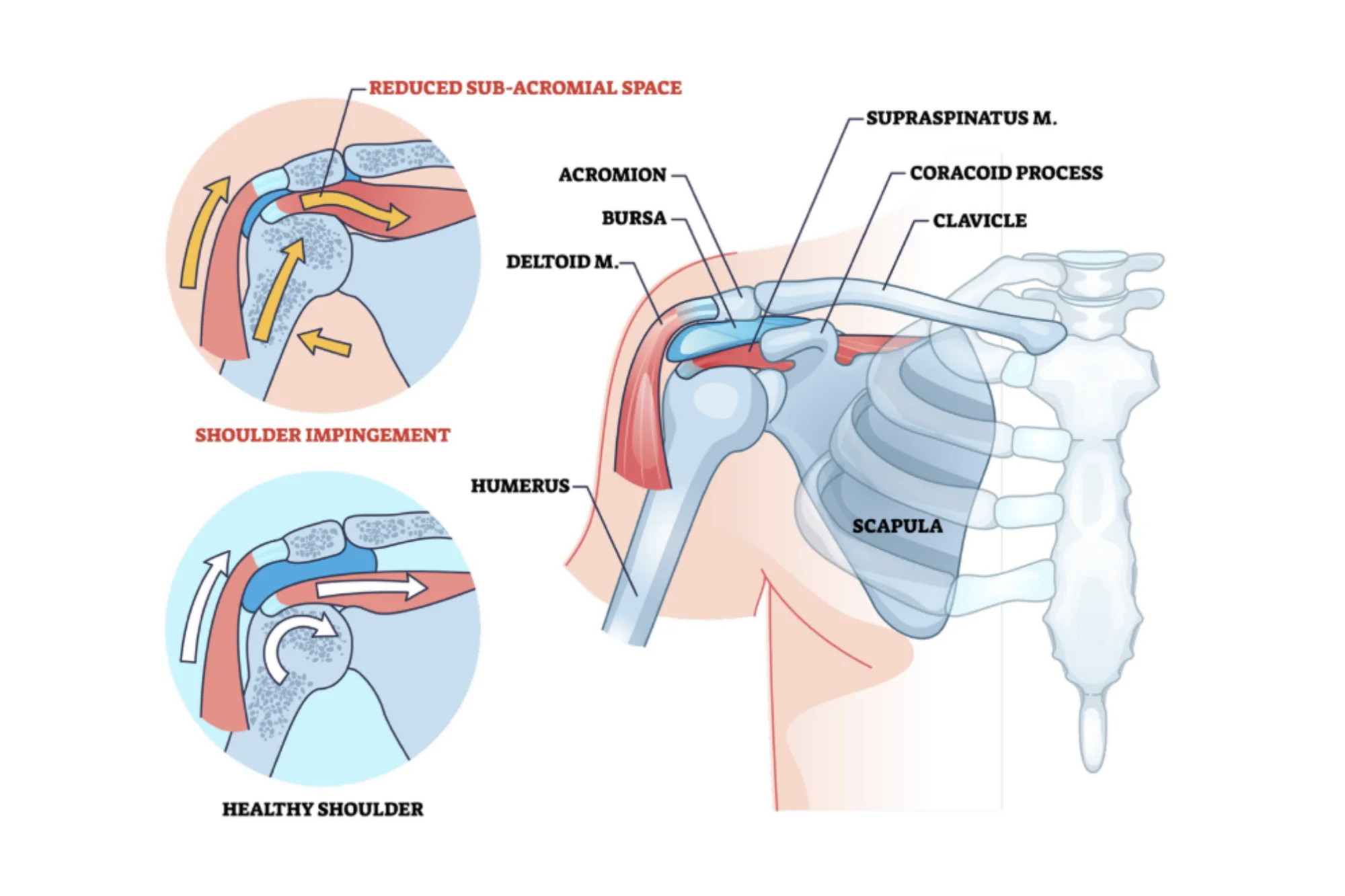 Diagram of shoulder anatomy